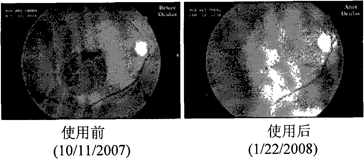 Point eye mask and preparation method and application thereof