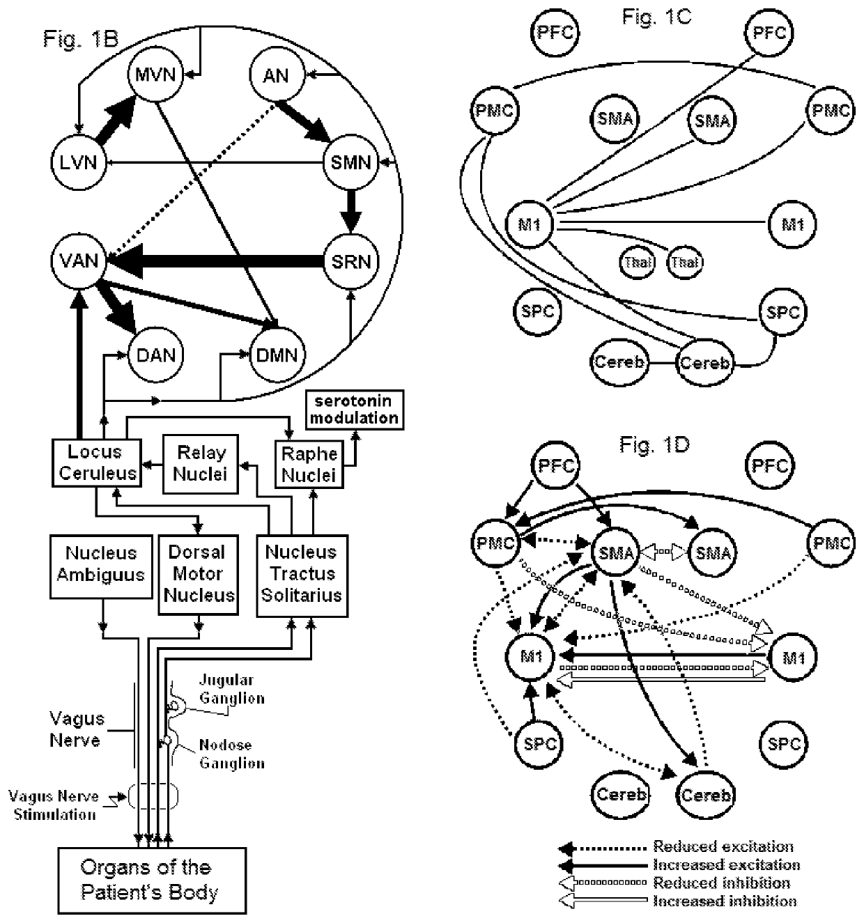 Vagal nerve stimulation for treating or preventing stroke or transient ischemic attack