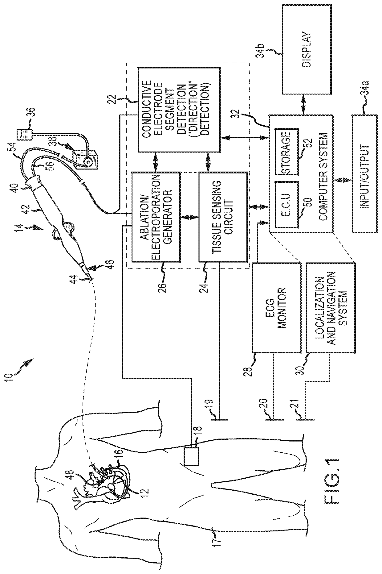 Asymmetric balanced waveform for AC cardiac irreversible electroporation