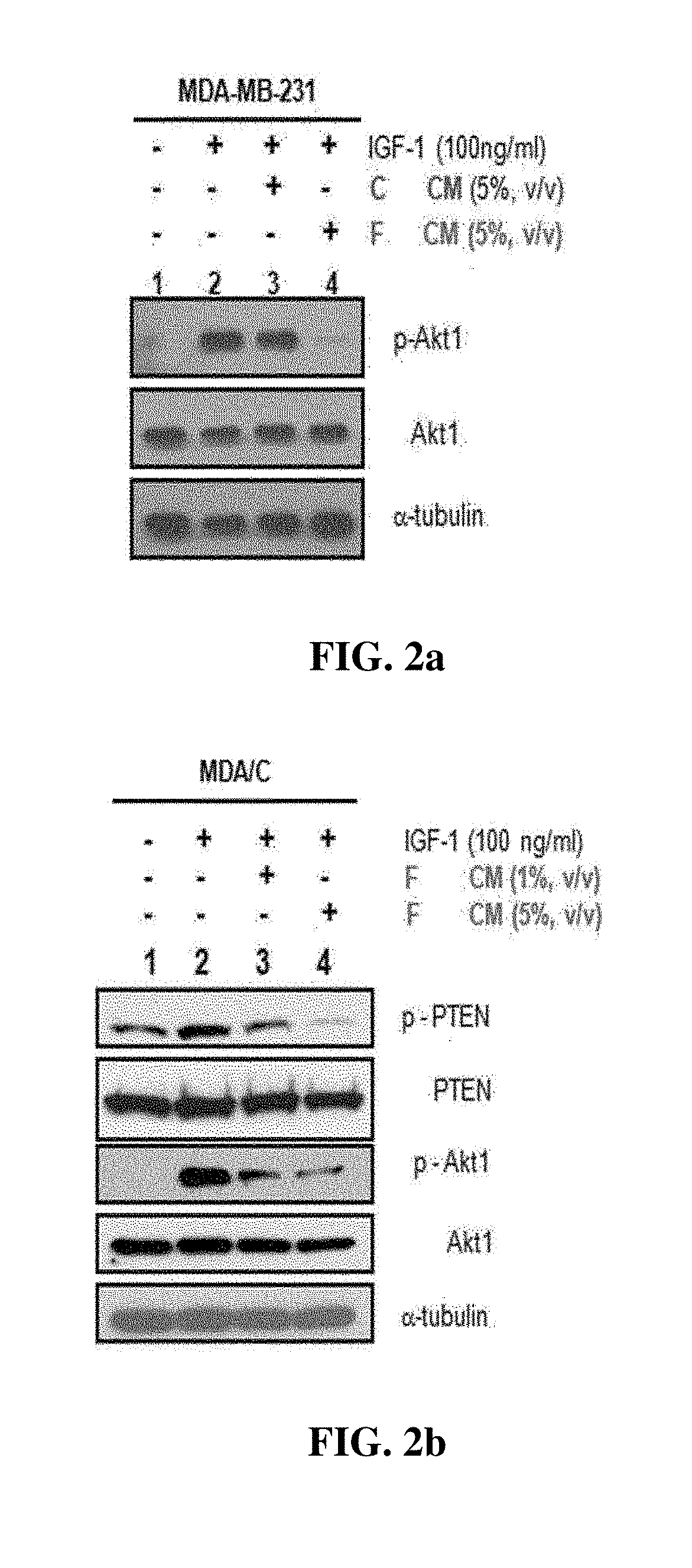 Pharmaceutical composition for preventing and treating cancer or cancer metastasis, containing fstl1 protein as active ingredient