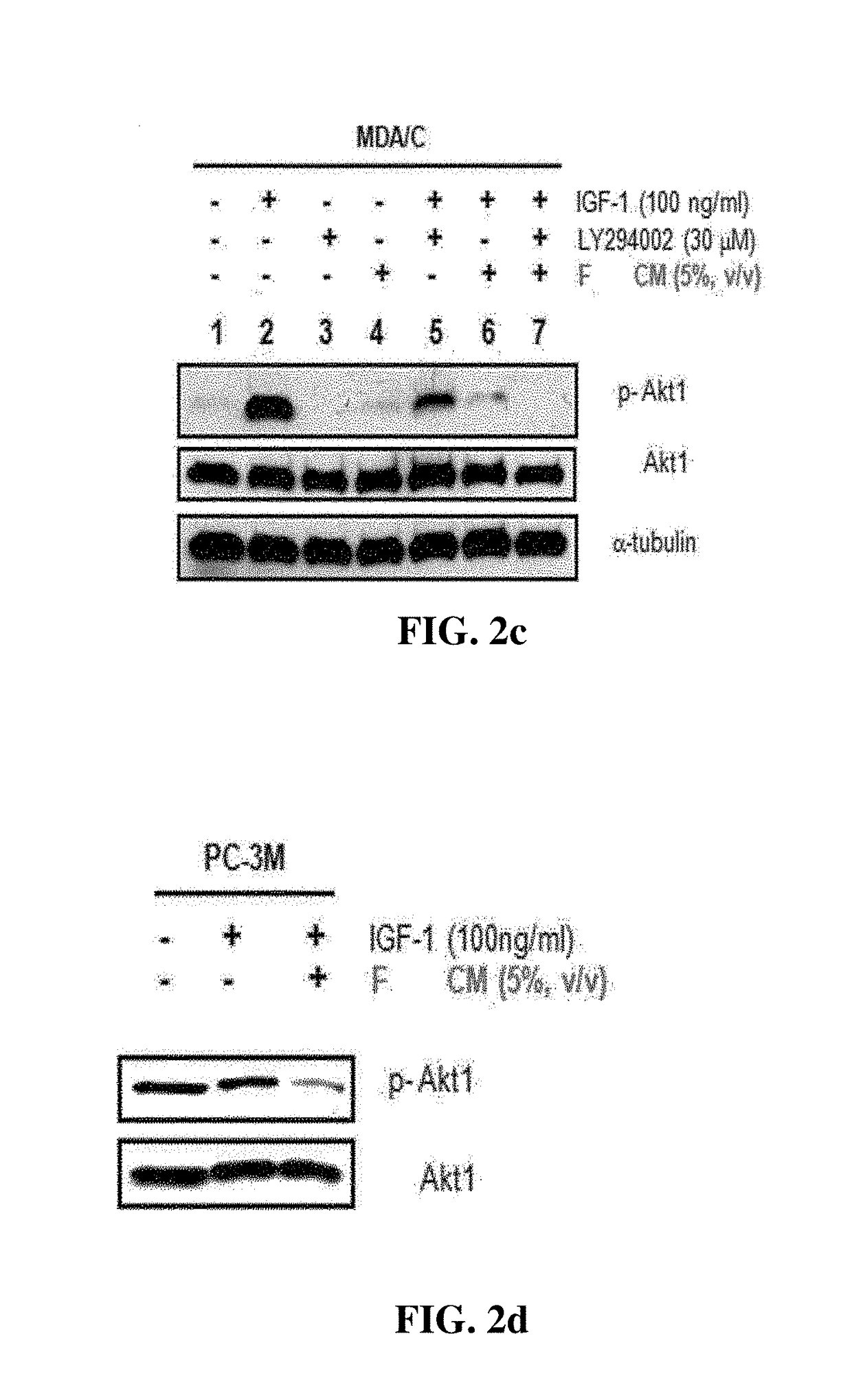 Pharmaceutical composition for preventing and treating cancer or cancer metastasis, containing fstl1 protein as active ingredient