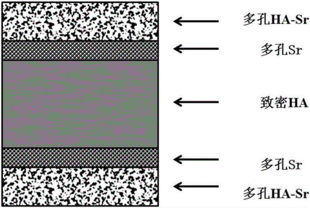 Preparation method of functionally graded porous HA-Sr bone filled support with active interlayer