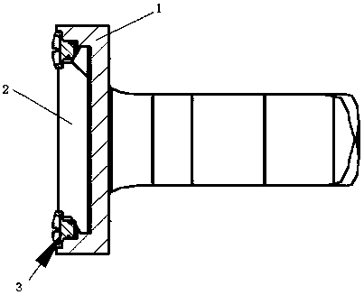 a sternum plate