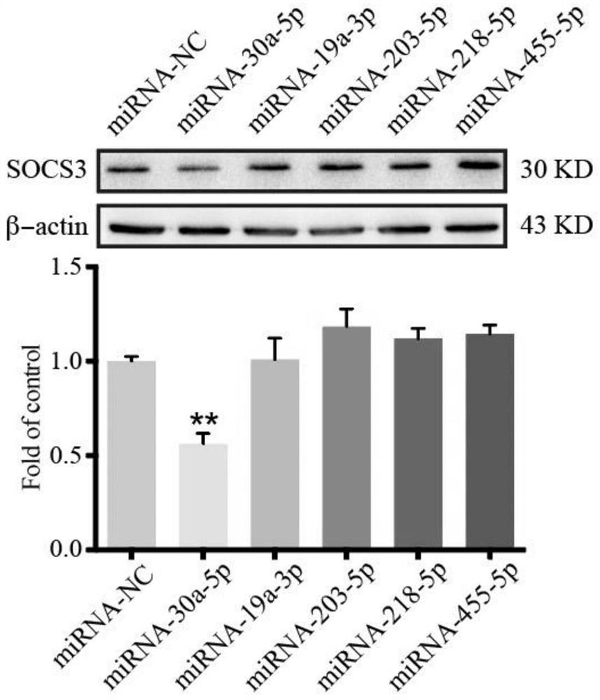 MicroRNA inhibitor capable of inhibiting SOCS3 down-regulation and preparation method thereof