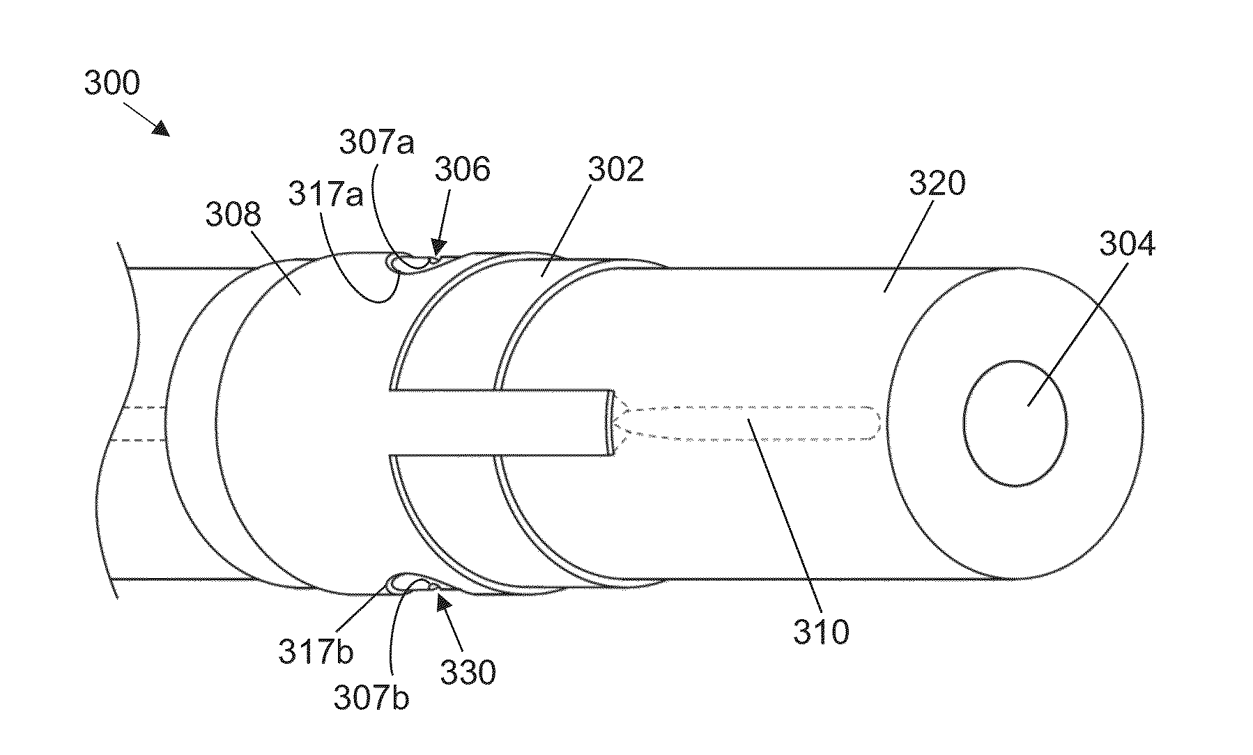 Low profile electrodes for an angioplasty shock wave catheter