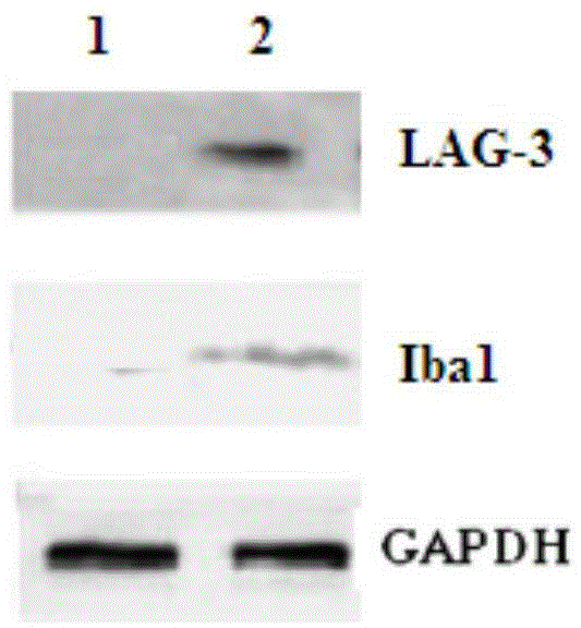 Iba1 and LAG-3 dual-gene co-expression recombinant adenovirus vector and preparation method and application thereof