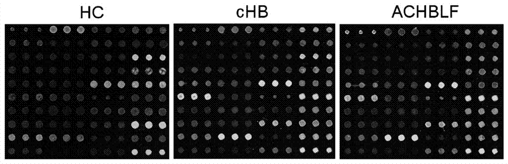 A lectin chip and kit for detecting sugar chain markers based on saliva and co-based on proteins in saliva and serum and its application