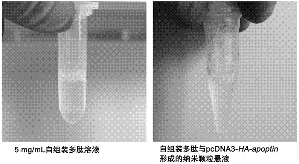 Self-assembled polypeptide-apoptin gene composite nanoparticle, and preparation method and application thereof