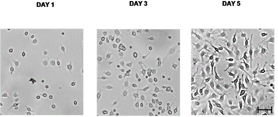 Method for extracting myelomonocyte and differentiating to osteoclast