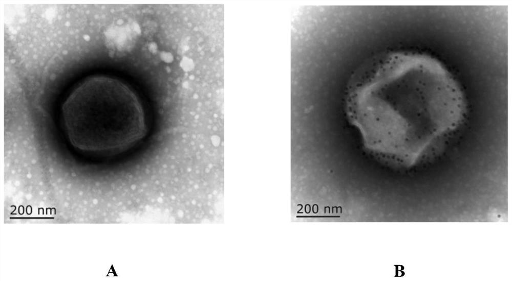 A gold nanoprobe-based method for the identification of individual Chlamydia pneumoniae