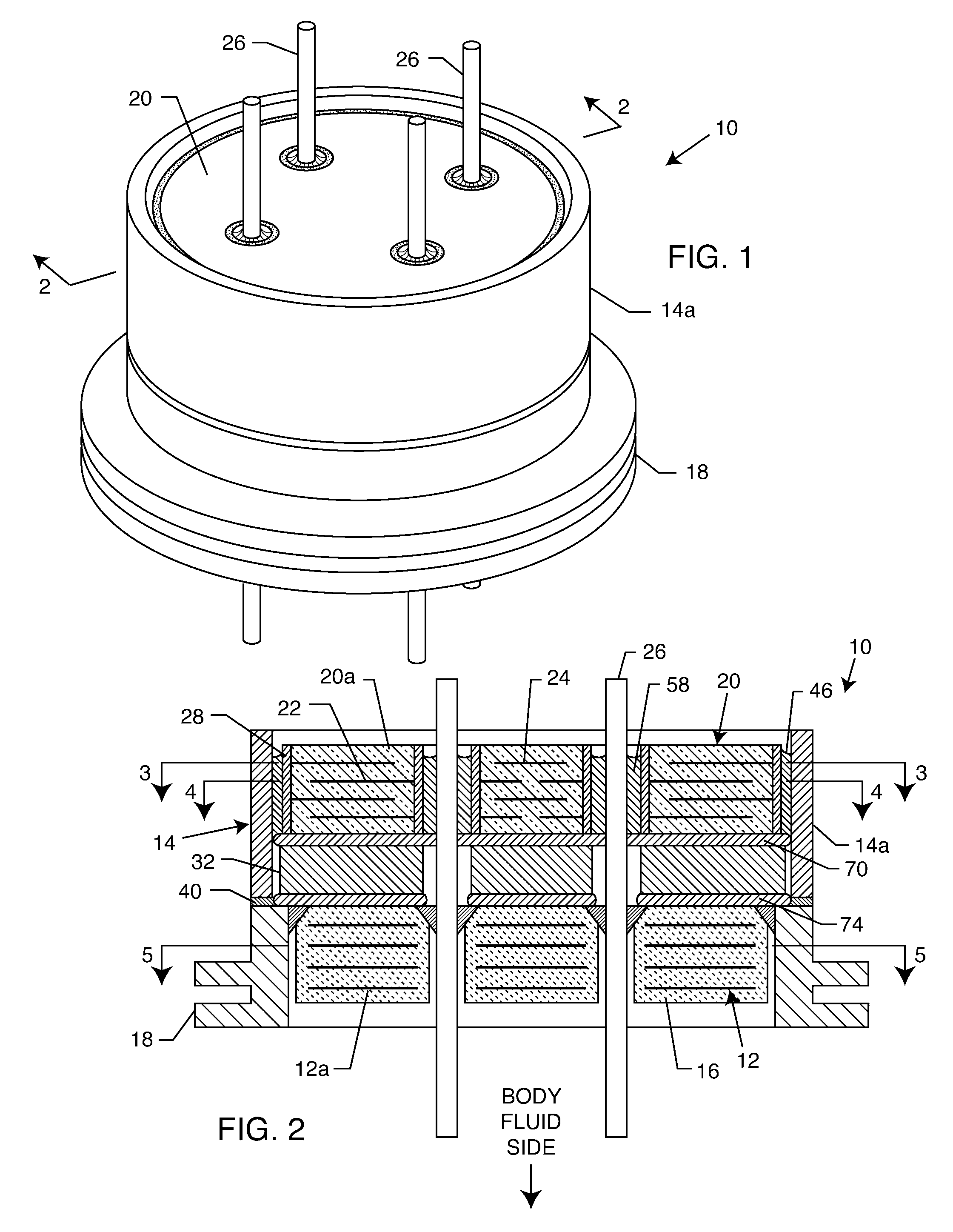 Apparatus and process for reducing the susceptibility of active implantable medical devices to medical procedures such as magentic resonance imaging