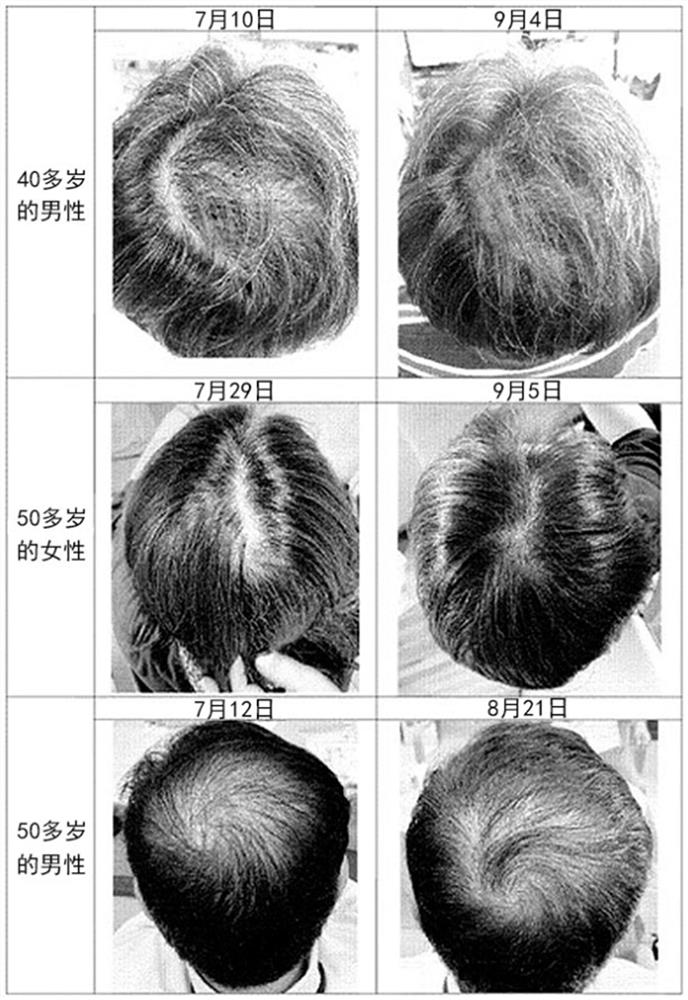 External agent for hair growth or hair loss prevention