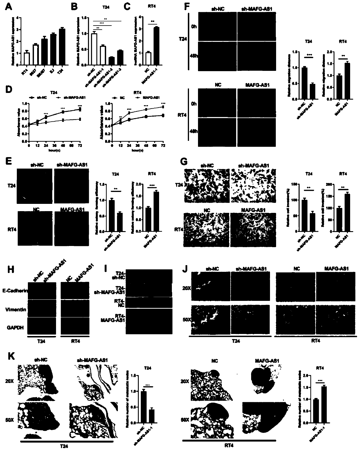 Application of detection reagent with MAFG-AS1 as target site to preparation of drugs for treating bladder cancer