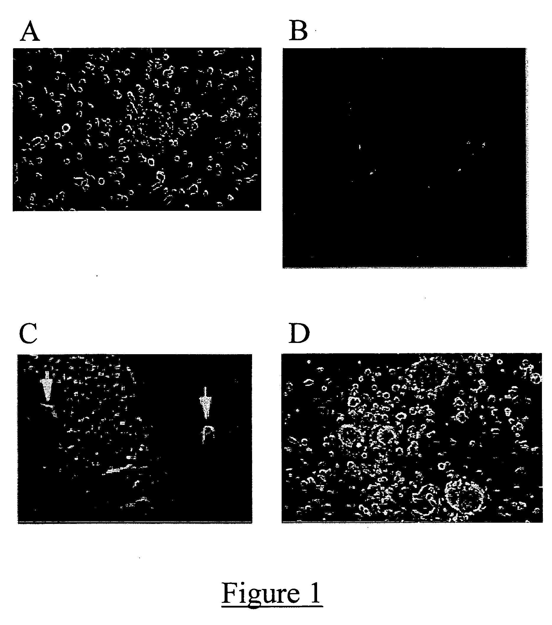 Method for treating a condition with neural progenitor cells derived from whole bone marrow