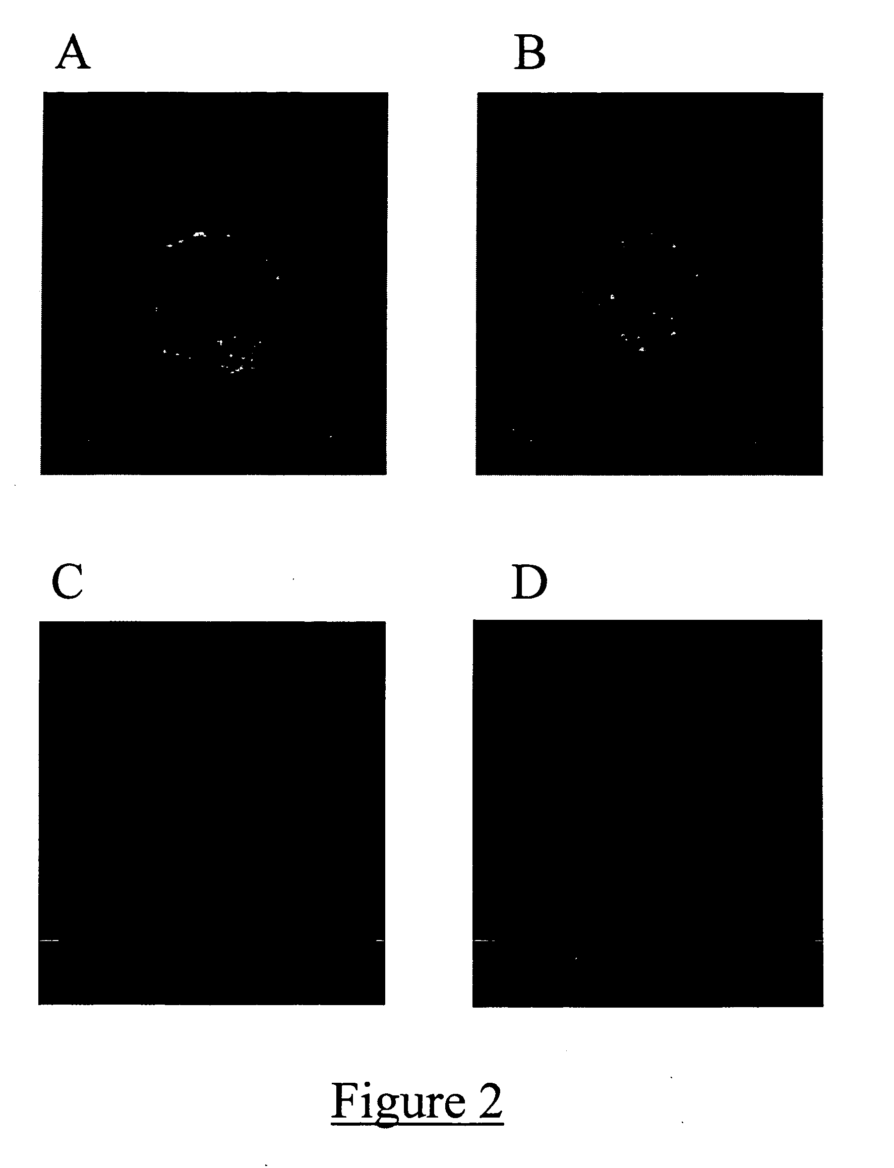 Method for treating a condition with neural progenitor cells derived from whole bone marrow