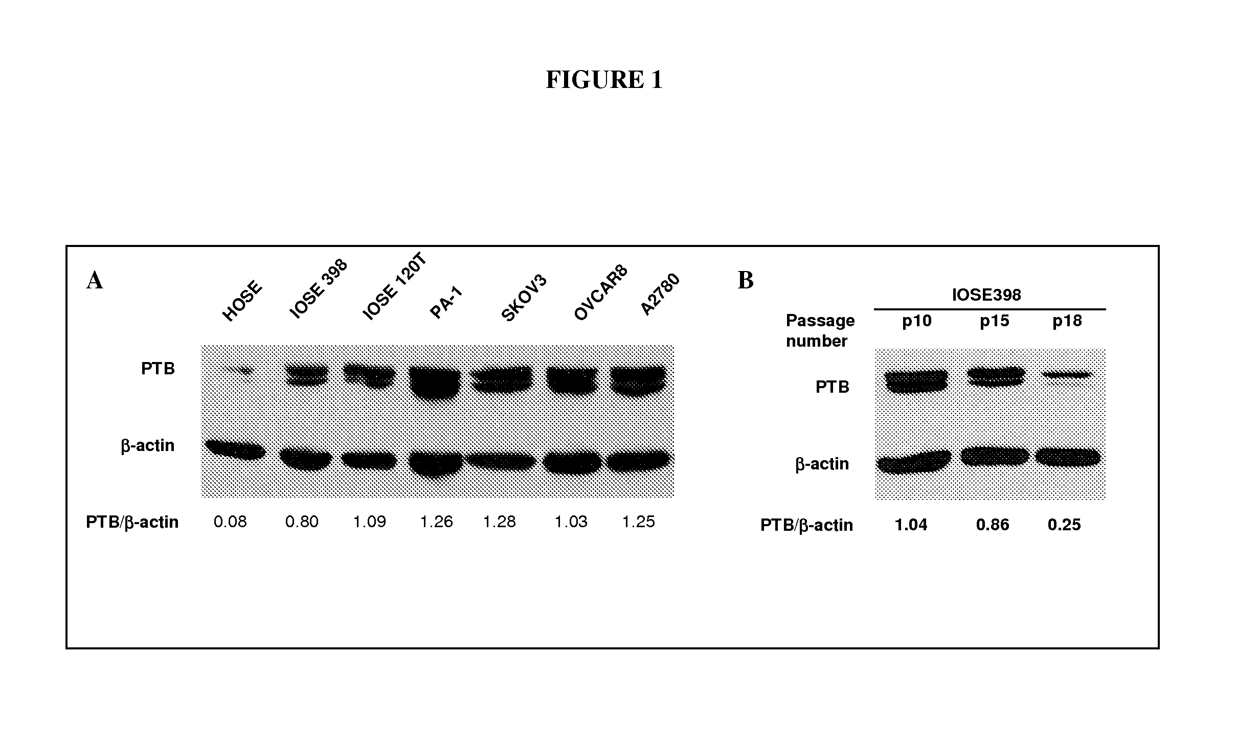 Methods for Identifying Modulators of Pyrimidine Tract Binding Protein