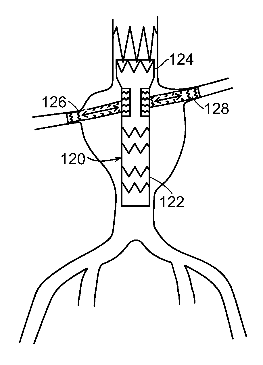 Stent graft with internal tunnels and fenestrations and methods of use