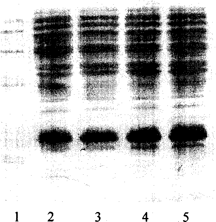 Method for producing recombinant human granulocyte colony stimulating factor
