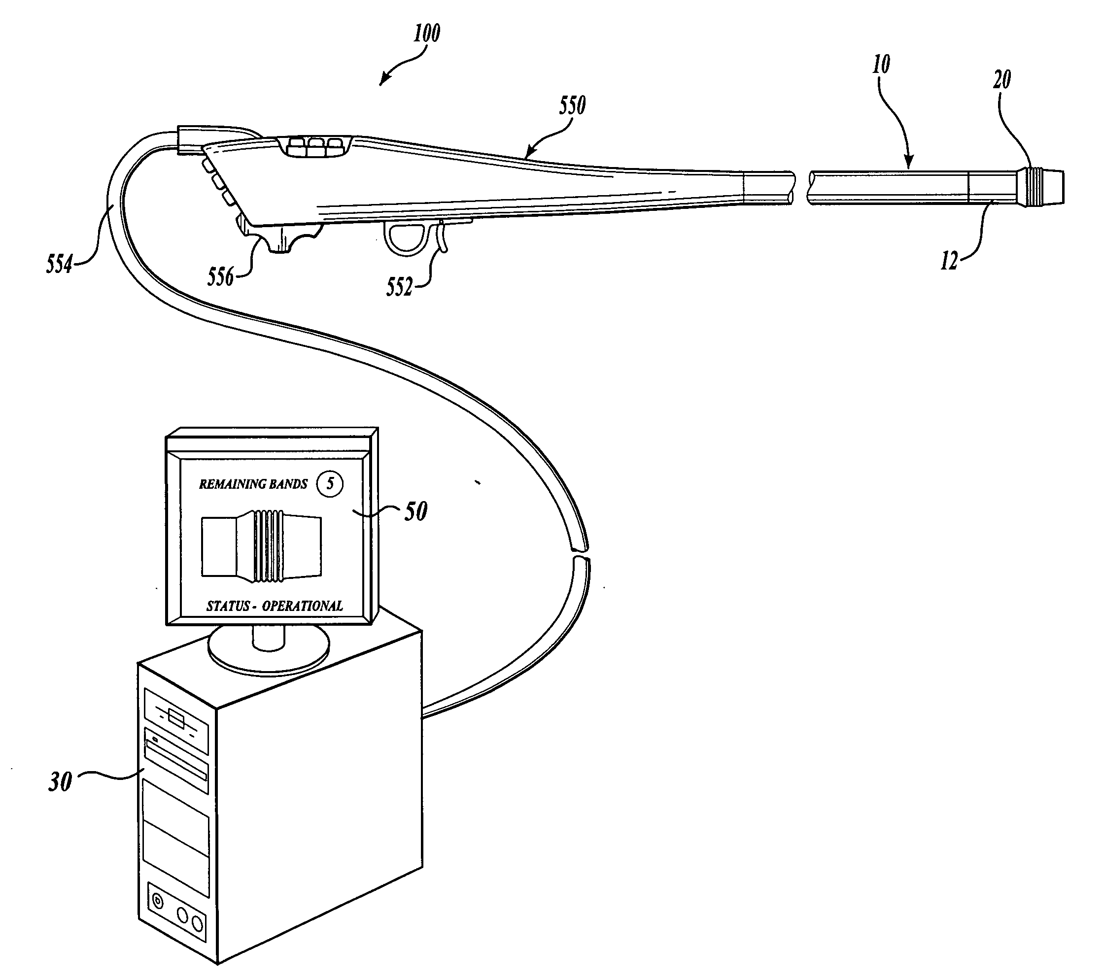 Endoscopic apparatus with integrated variceal ligation device