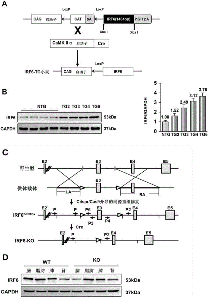 Interferon regulatory factor (IRF) 6 and application of IRF 6 inhibitor to brain stroke disease