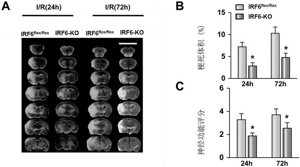 Interferon regulatory factor (IRF) 6 and application of IRF 6 inhibitor to brain stroke disease