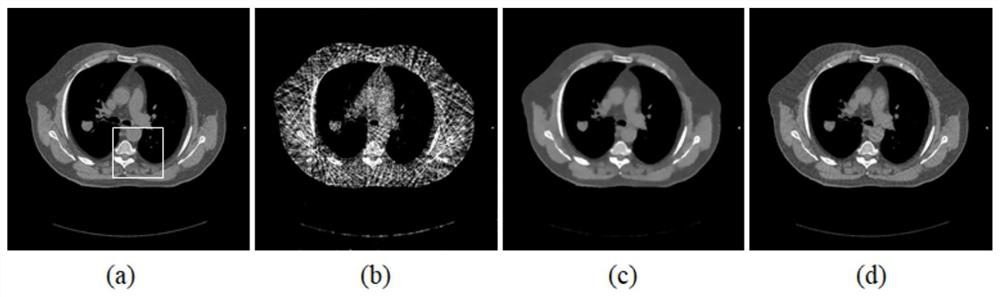 4D-CBCT reconstruction method combining motion estimation and space-time tensor enhanced representation