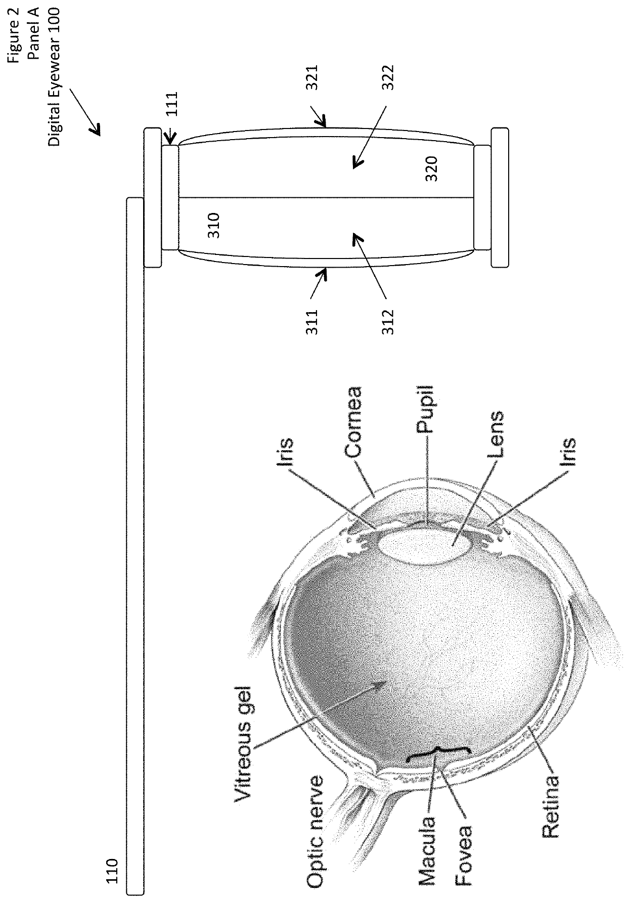 Digital eyewear system and method for the treatment and prevention of migraines and photophobia