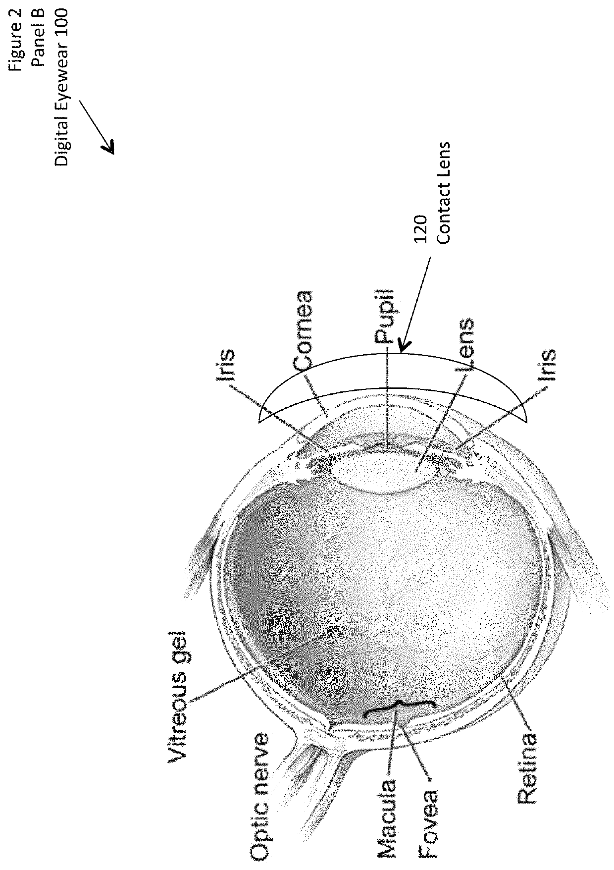 Digital eyewear system and method for the treatment and prevention of migraines and photophobia