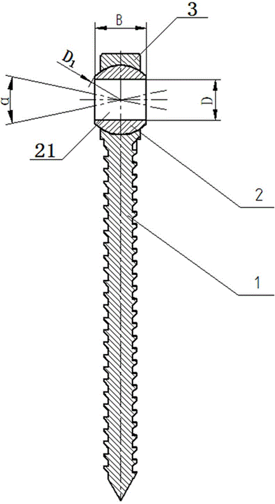 Self-adaptive pedicle screw