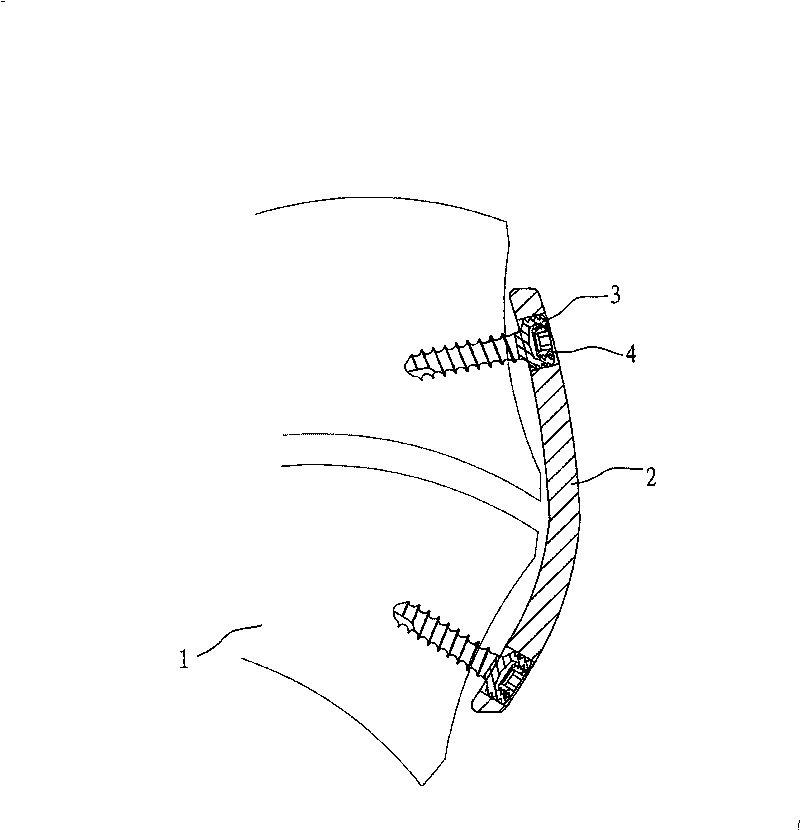 Minimally invasive dual-locking implantation system for cervical vertebra