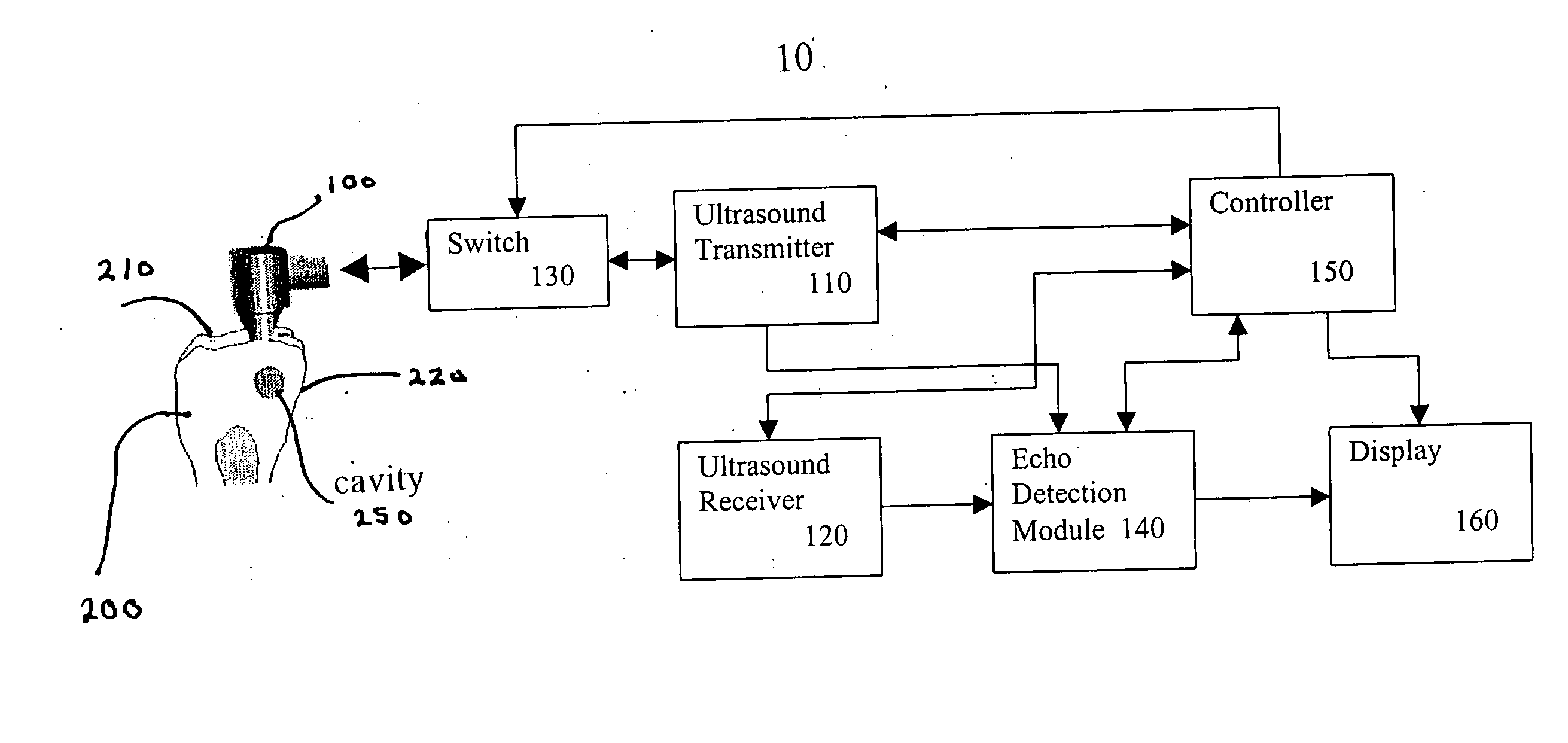 Portable ultrasonic device and method for diagnosis of dental caries