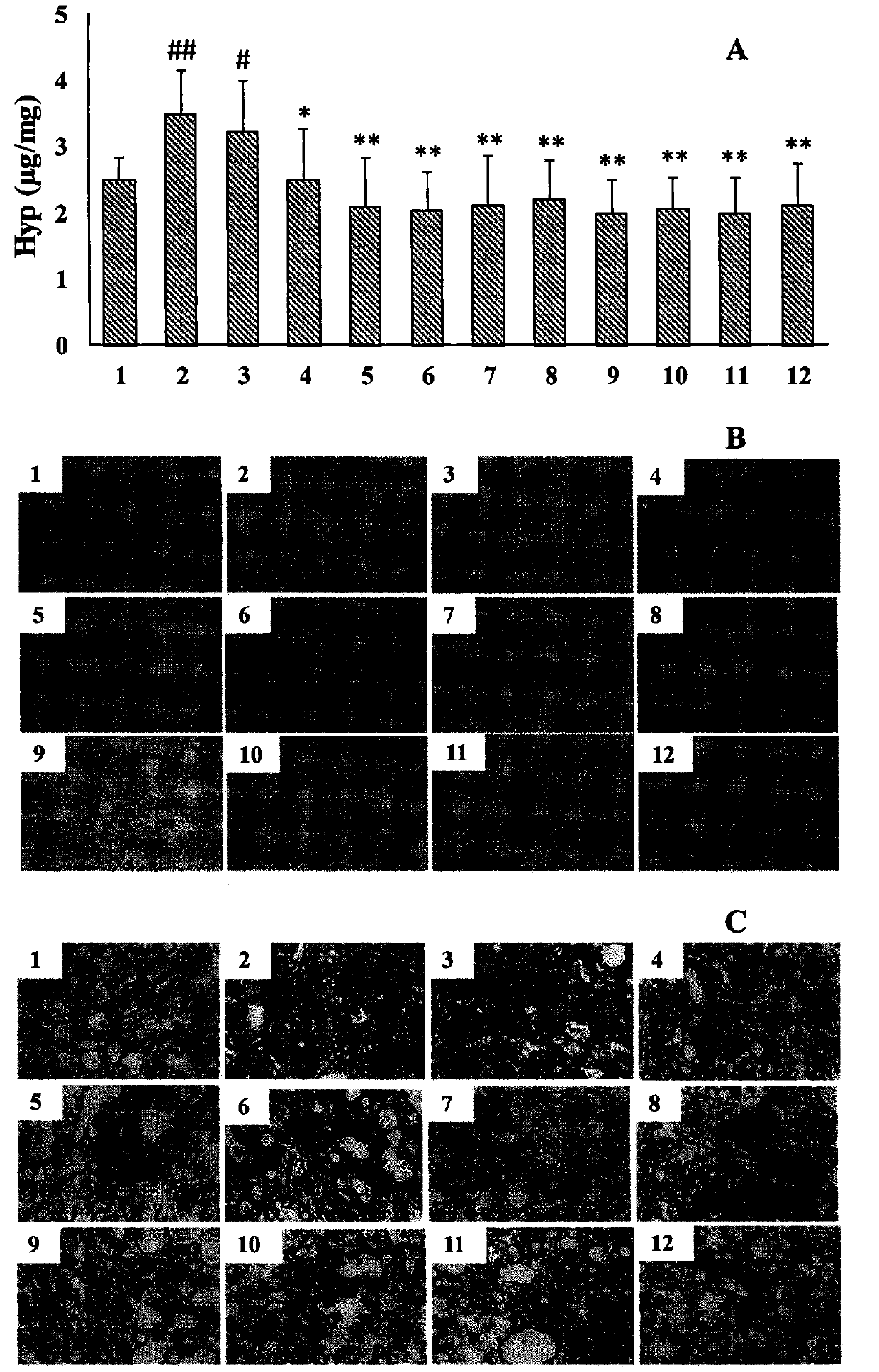 Application of alkaloid in preparing pharmaceutical compositions for preventing and treating pulmonary fibrosis