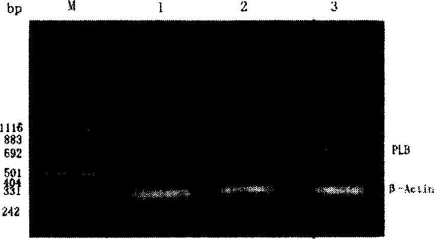 Phosphoric acid receptor protein gene glandular related viral vector and construction and application