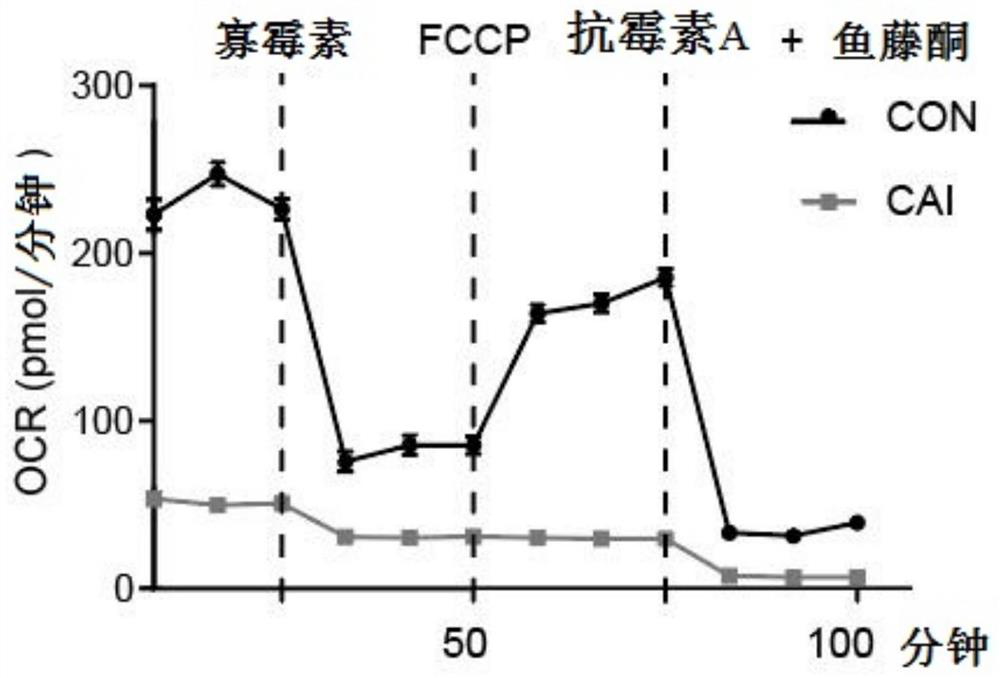 Use of carboxytriazole and glutamic acid uptake and metabolism inhibitors in antitumor