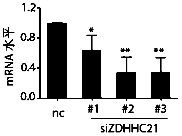 Application of ZDHHC21 genes in preparation of leukemia induced differentiation therapy drugs