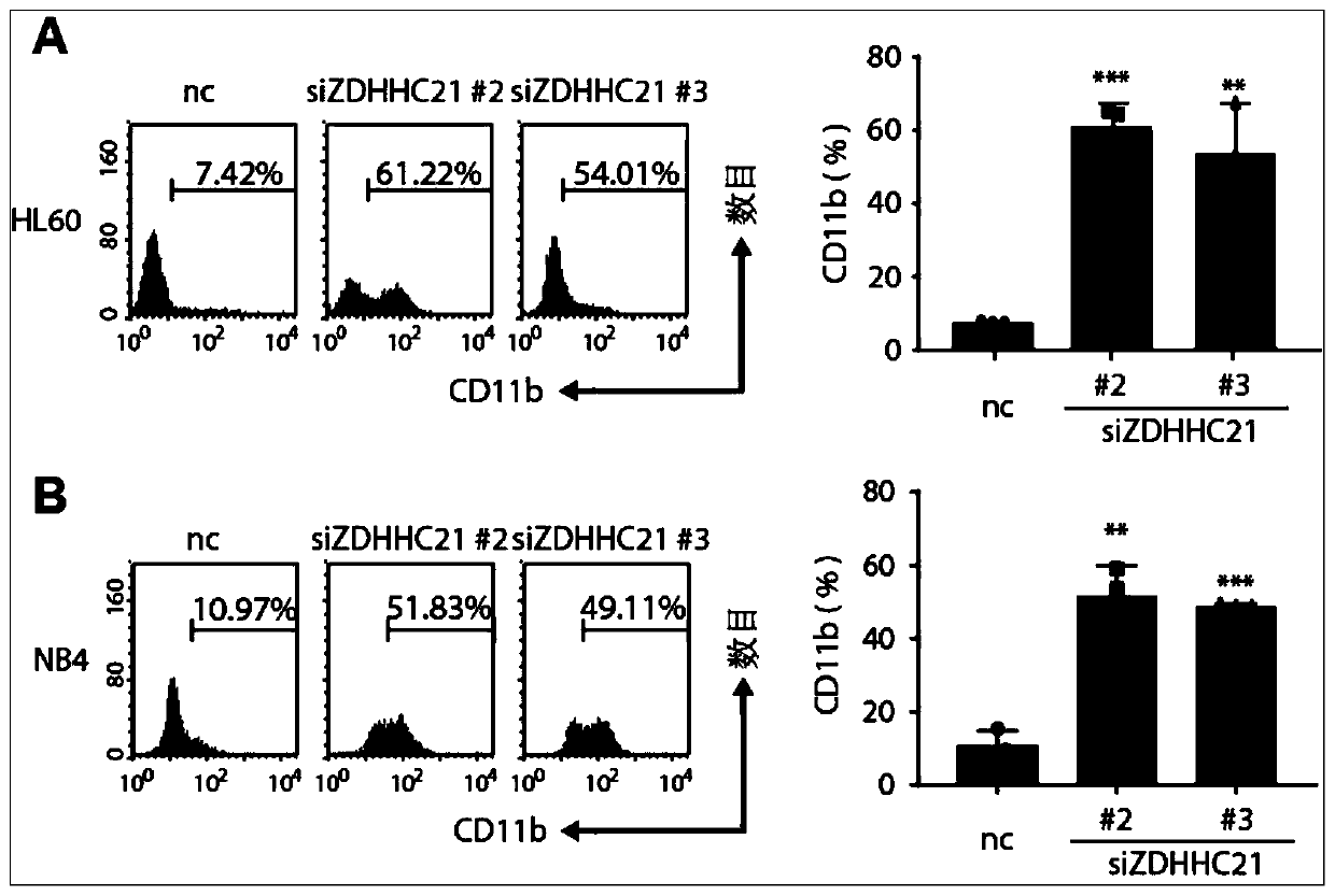 Application of ZDHHC21 genes in preparation of leukemia induced differentiation therapy drugs
