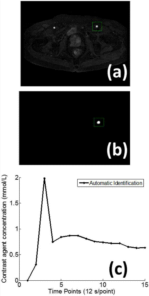 Pharmacokinetic parameter estimation method based on contrast agent enhancement curve