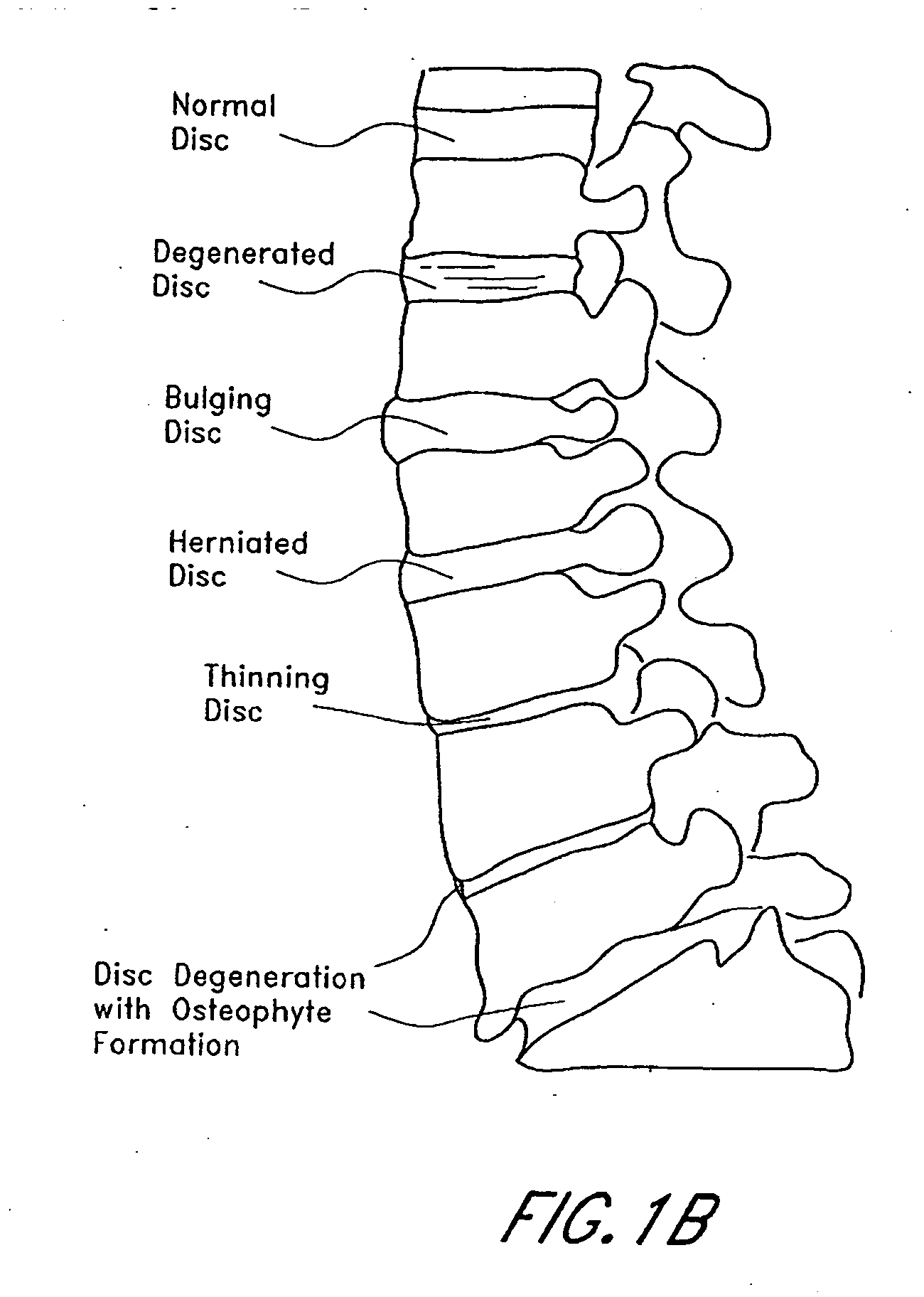 Exchange system for axial spinal procedures