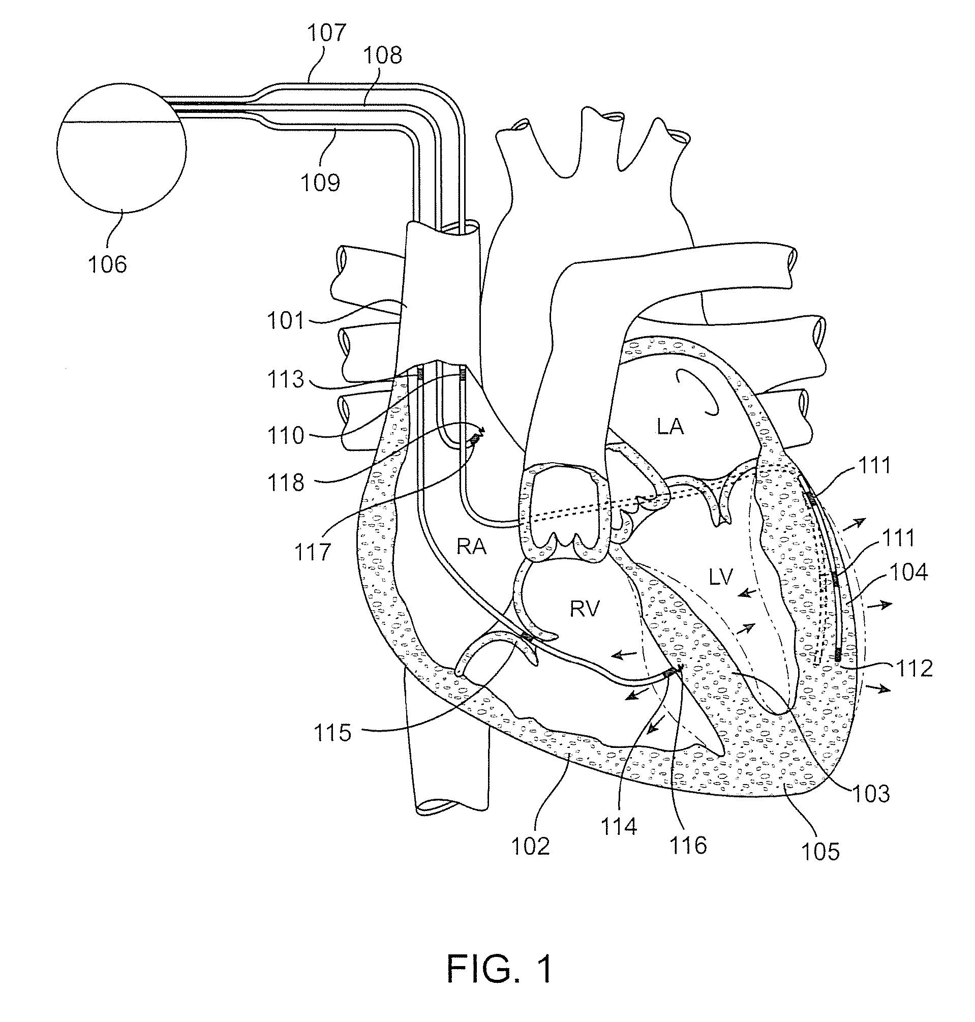 Electric field tomography