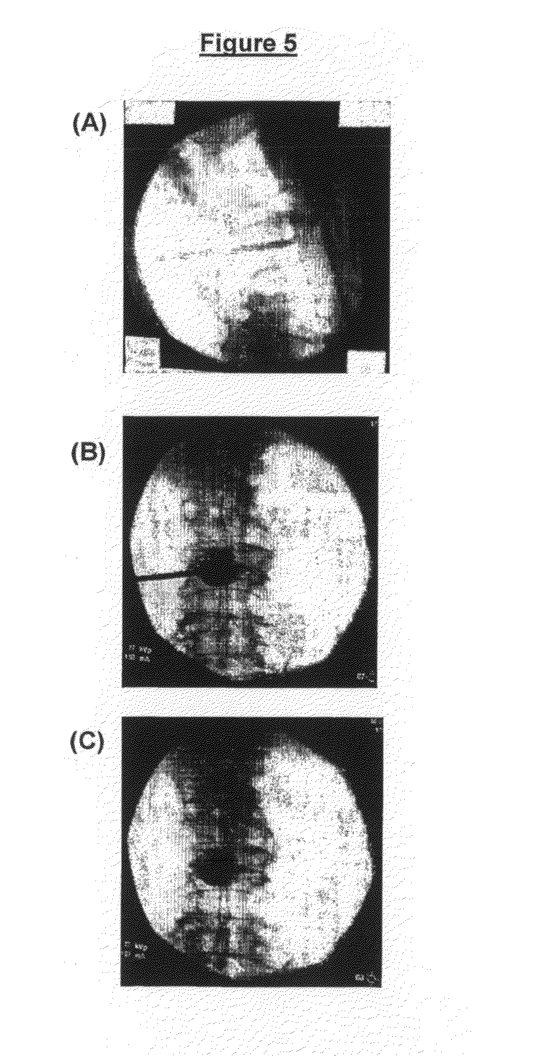 Bone and/or dental cement composition and uses thereof