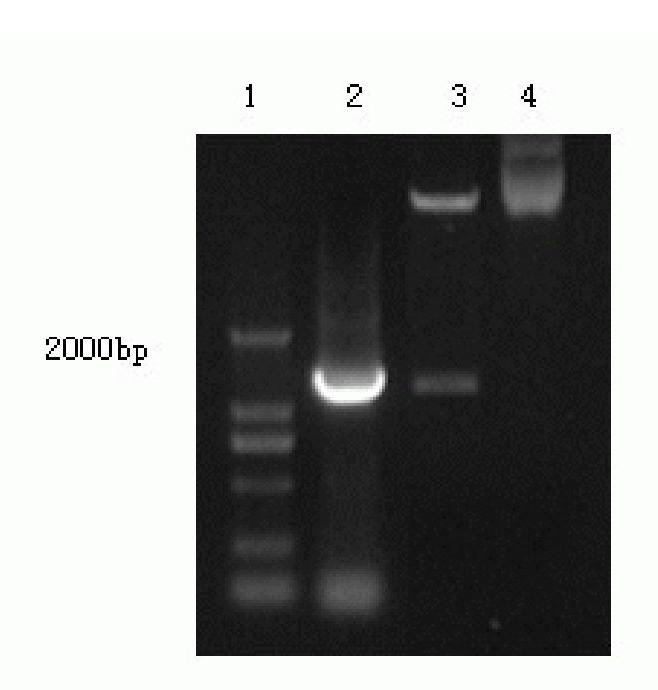 Fusion protein and encoding gene thereof as well as application of fusion protein