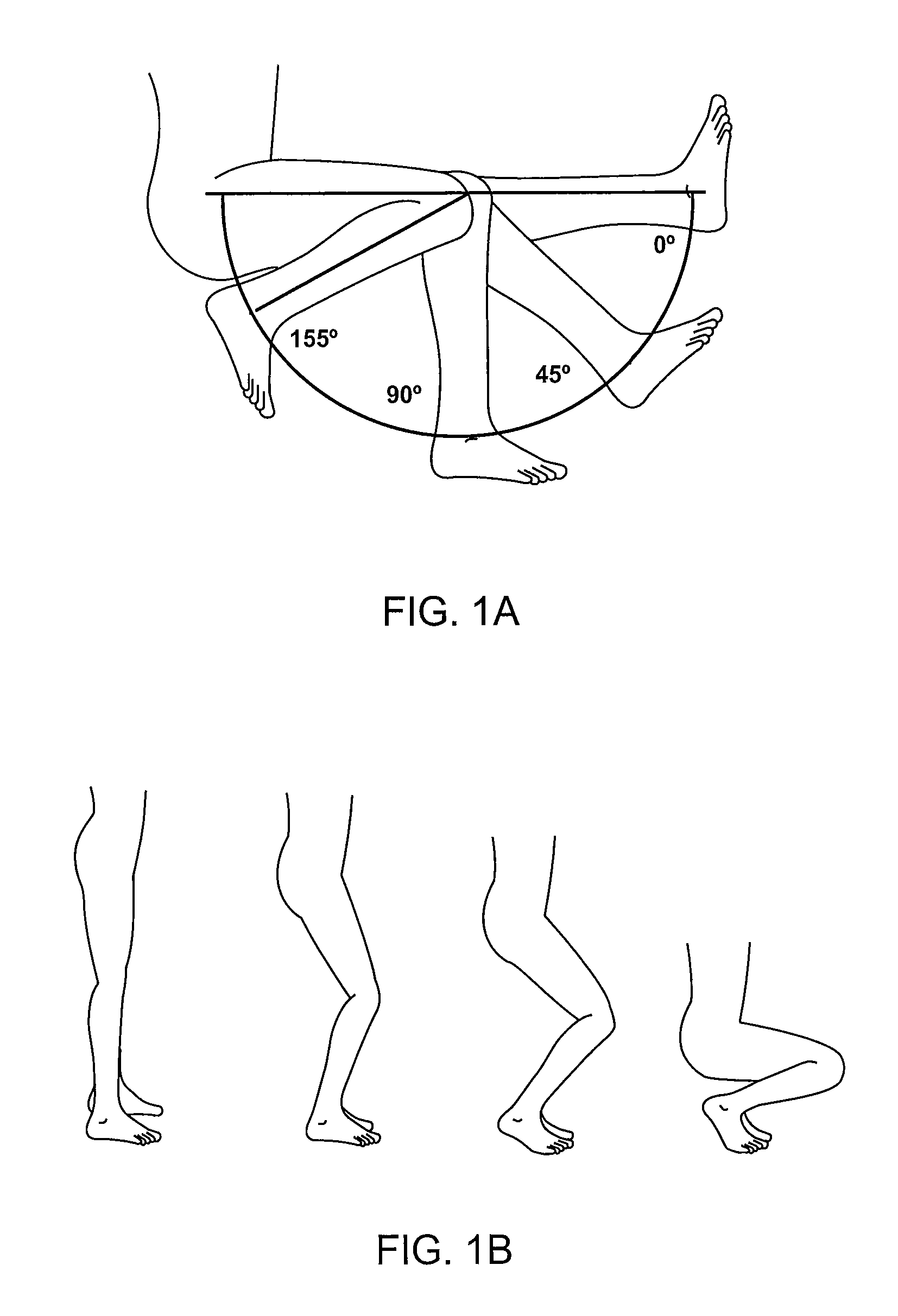 Systems and methods for providing deeper knee flexion capabilities for knee prosthesis patients
