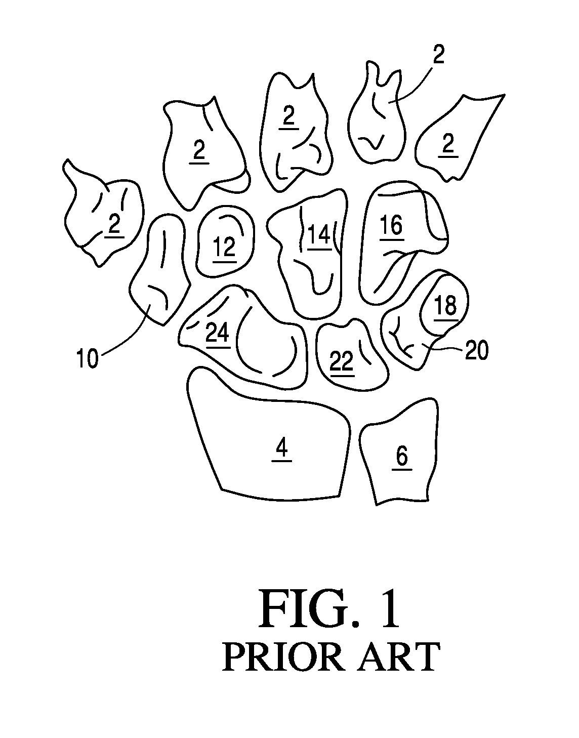 Bone prosthesis for maintaining joint operation in complex joints