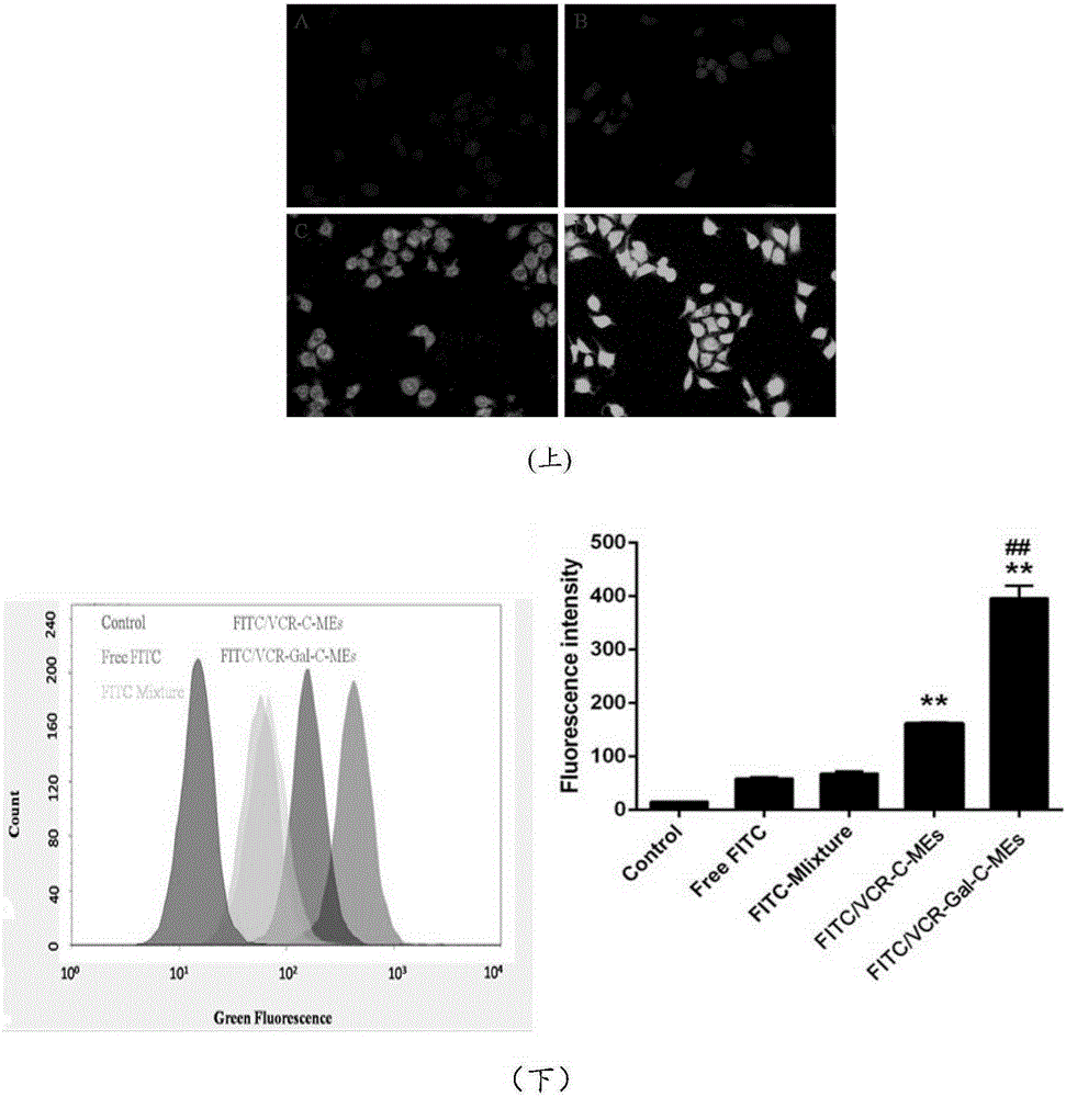 Galactose ester modified traditional Chinese and western medicine jointly-loaded orally-taking liver-targeting microemulsion delivery system