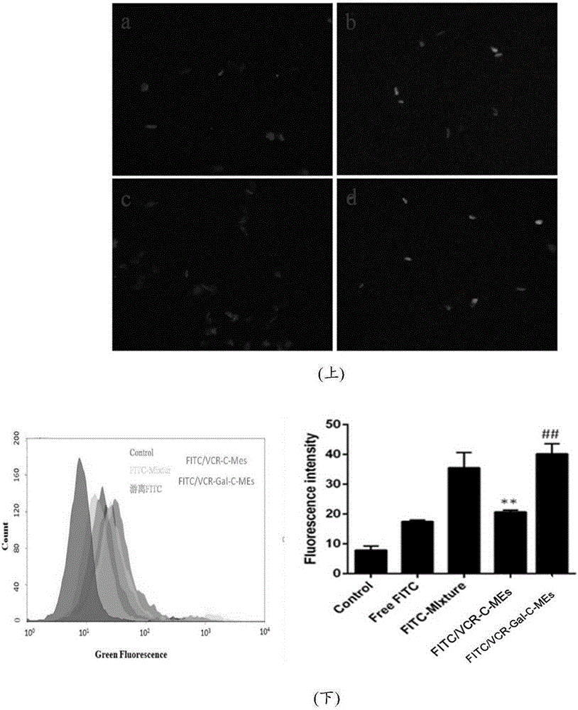 Galactose ester modified traditional Chinese and western medicine jointly-loaded orally-taking liver-targeting microemulsion delivery system