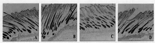 A kind of raw material formula for preventing and growing hair