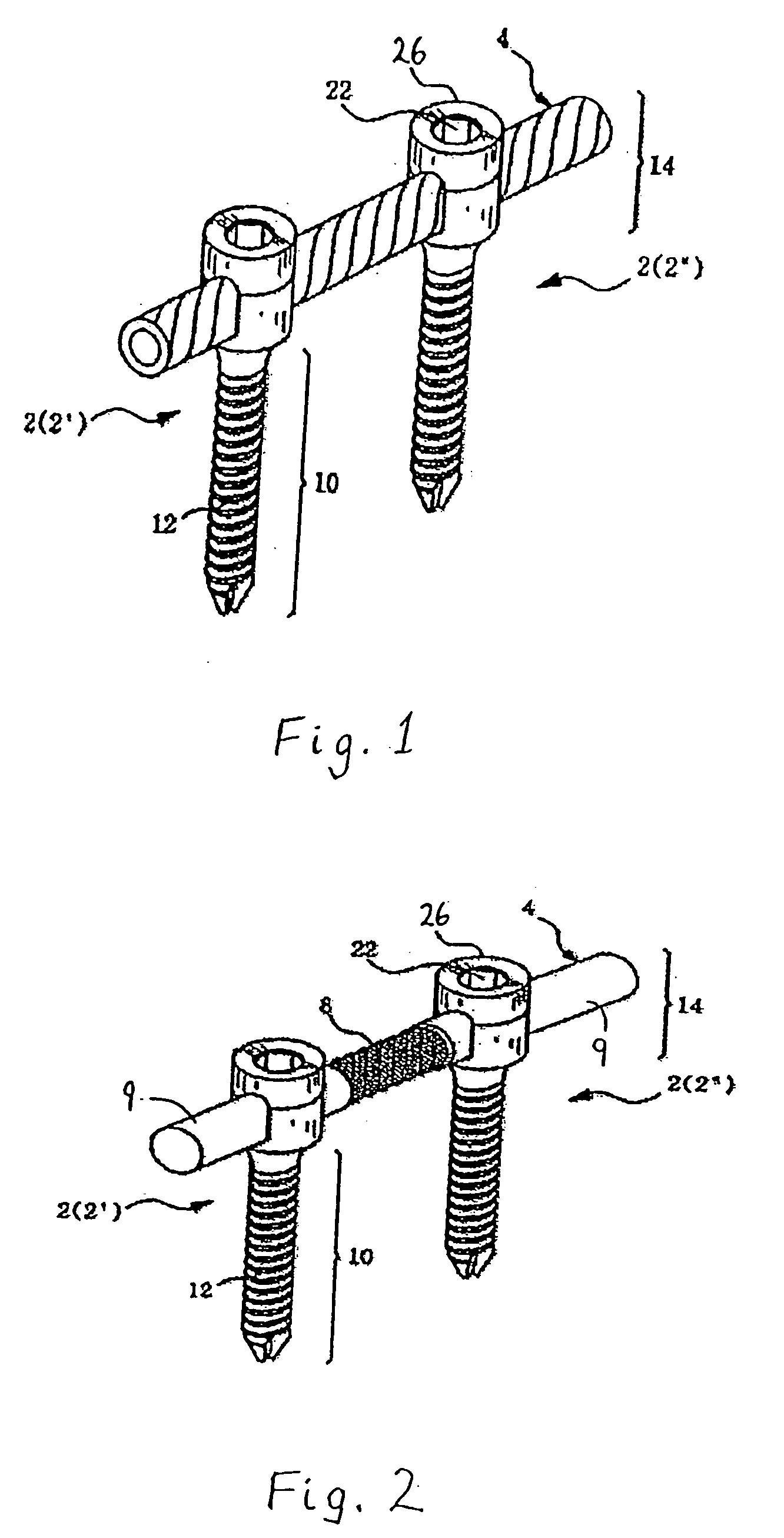 Method and apparatus for flexible fixation of a spine