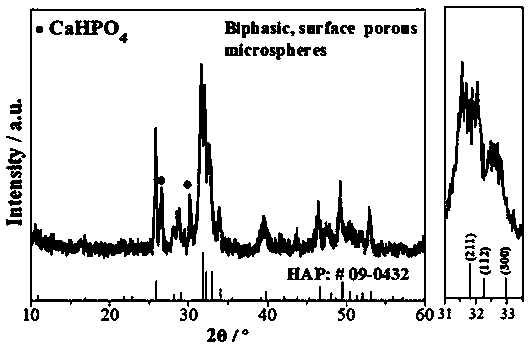 Anhydrous calcium hydrophosphate/hydroxyapatite biphasic porous microsphere material, and preparation method and application thereof