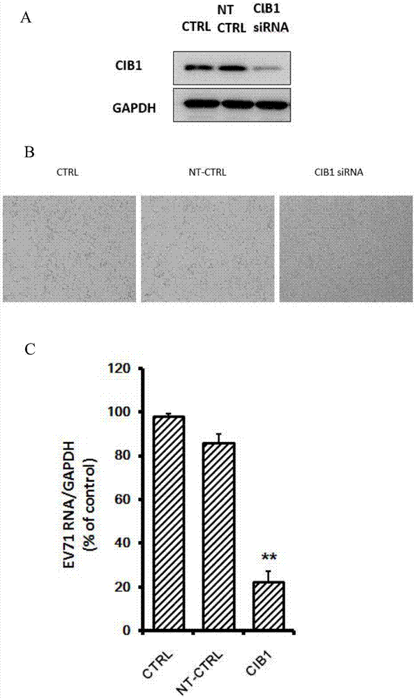 Applications of calcium-and inte-grin-binding protein 1 in preventing and treating enterovirus 71 infection