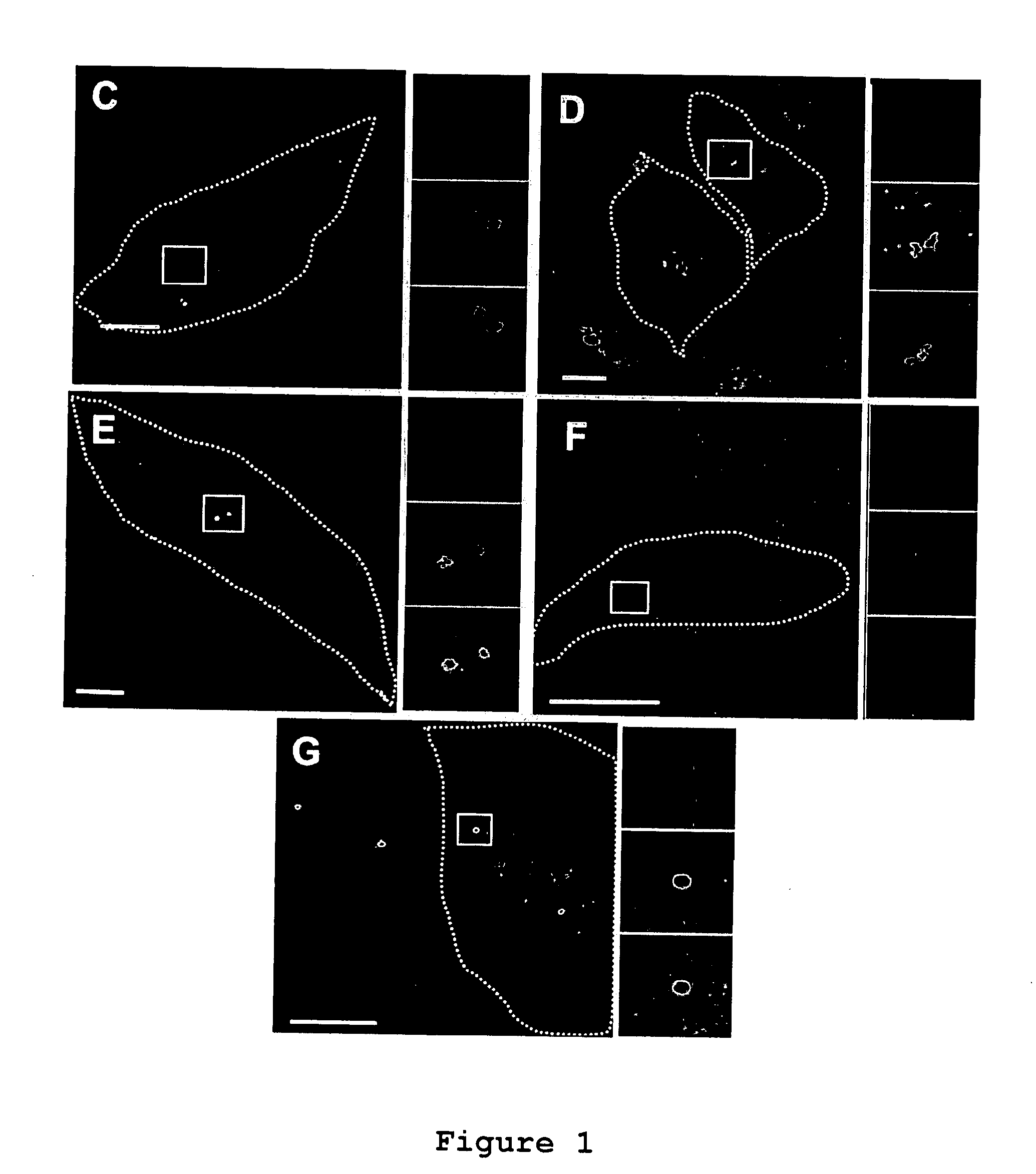 Compositions and Methods for the Treatment of Diseases Associated with Aberrant Cilia Assembly and Regulation